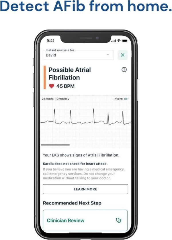 KardiaMobile 1-Lead Personal EKG Monitor – Record at Home – Detects AFib & Irregular Arrhythmias – Easy Results in 30 Seconds – Works w/Most Smartphones - FSA/HSA Eligible